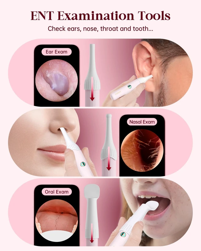 Alt view image 5 of 7 - Ear Wax Removal Tool Camera, Ear Cleaning Kit with Flexible Visual Ear Camera Otoscope, Portable Wireless Painless Ear Cleaner with Earwax Remover Tweezers for Adults Kids Pets(Pink)