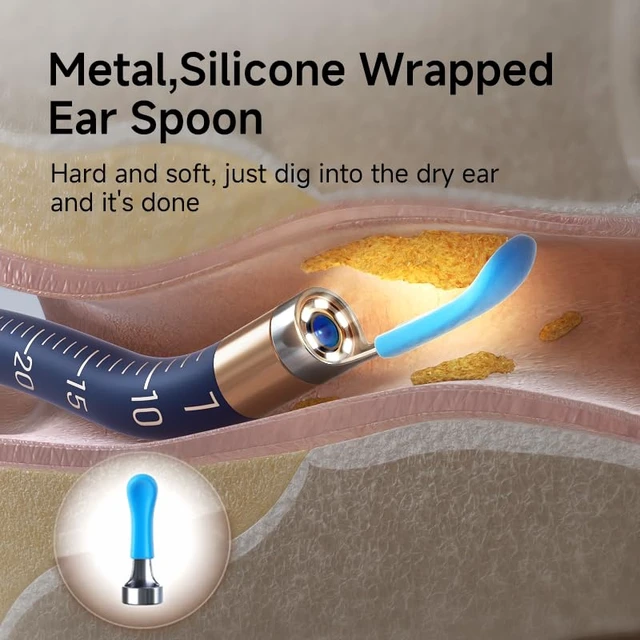 Alt view image 7 of 7 - Replacement Tips Ear 14 Pieces Waterproof Silicone Ear Spoon for Ear Wax Removal Endoscope BEBIRD Original Ear Cleaner Tips Set for Bebird Earsight Plus R37R/ B31R/ D39R & R1 Ultra