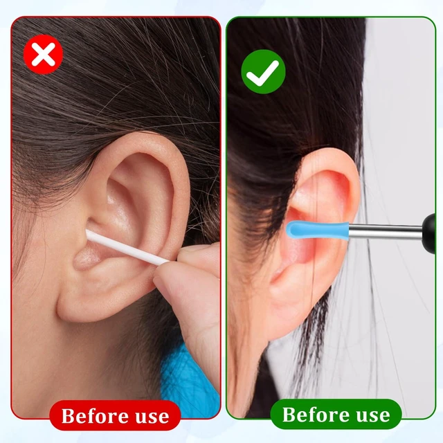 Alt view image 5 of 7 - 60Pcs Ear Wax Removal Tool Replacement Tips Replacement Tips Ears | Blue Silicone Aural Cleaner Cap Set, Reusable Accessory for Wet Dry Ear Wax Cleaning, Compatible with Most Aural Picks