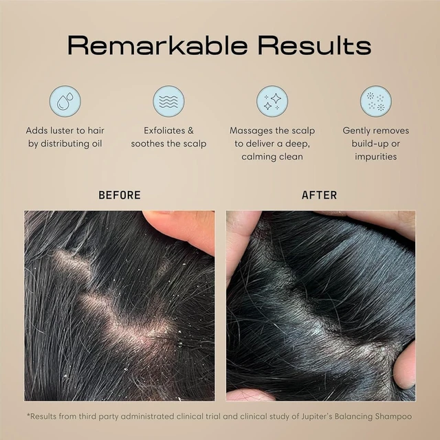 Alt view image 2 of 7 - Scalp Exfoliator - Scalp Massager Tool for Wet & Dry Hair - Ergonomic Detangler Brush - Dandruff Comb & Scrub to Remove Dandruff & Buildup and Support Circulation - Black/White