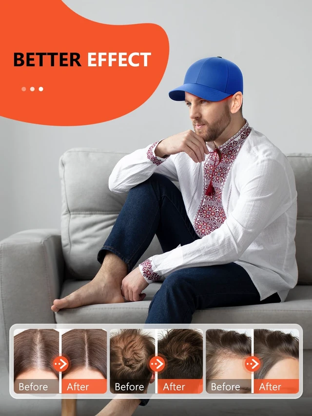 Alt view image 2 of 7 - Red Light Hair Growth Cap, Red Light Therapy for Head, Red Infrared Light Therapy 660nm & 850nm & 940nm wavelength with Timer & Controller, Color: Blue