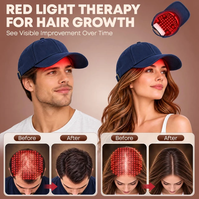 Alt view image 3 of 7 - Red Light Therapy for Hair Growth,Laser Hair Growth Cap,Blue | 650nm &880nm LLLT Red Infrared Therapy Cap for Men & Women,FullScalp Hair Regrowth,Rechargeable,Adjustable HandsFree Wear