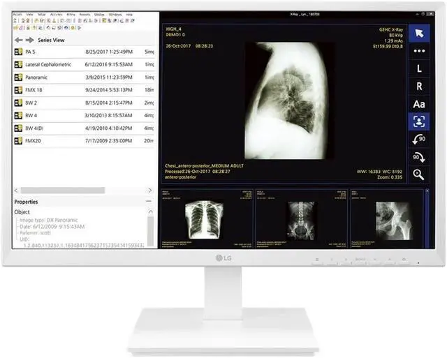 Alt view image 12 of 20 - LG 24CK560N 23.8" AIO Healthcare Computer AMD GX-212JJ 4GB 32GB SSD No OS