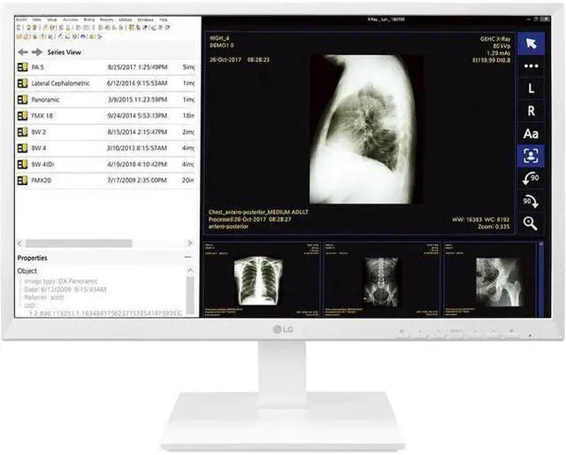 Alt view image 13 of 20 - LG 24CK560N 23.8" AIO Healthcare Computer AMD GX-212JJ 4GB 32GB SSD No OS