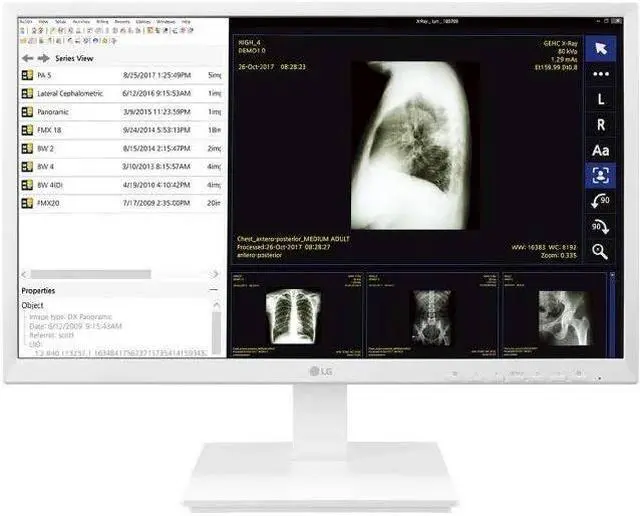Main image of LG 24CK560N 23.8" AIO Healthcare Computer AMD GX-212JJ 4GB 32GB SSD No OS