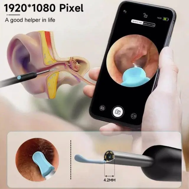 Alt view image 4 of 7 - Wireless Ear Wax Remover Camera HD Ear Endoscope Spoon Pick Cleaning Tools Set
