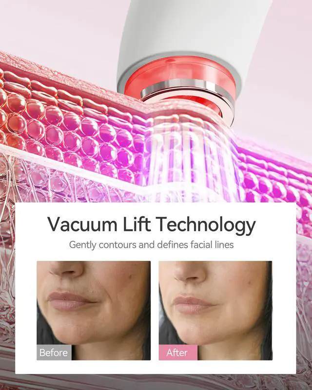 Alt view image 3 of 7 - Red Light Therapy Device for Face and Neck, 3-in-1 Microcurrent & Vacuum Facial Massager, Skin Tightening, Firming and Anti-Aging Skincare Tool (White)