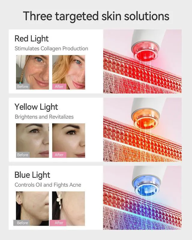 Alt view image 5 of 7 - Red Light Therapy Device for Face and Neck, 3-in-1 Microcurrent & Vacuum Facial Massager, Skin Tightening, Firming and Anti-Aging Skincare Tool (White)