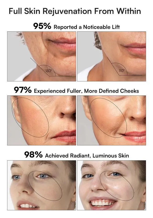 Alt view image 3 of 7 - 3-in-1 Skin Tightening Device True Beauty Glow Facial Massager Red Light Therapy for Face and Neck
