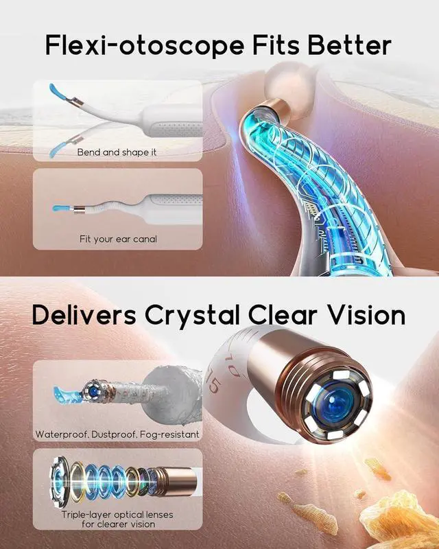 Alt view image 2 of 7 - Earsight Plus R37R Ear Wax Removal Tool Camera, FSA HSA Eligible Items, Smart Ear Cleaner with Painless Visual Tweezers, Flexible Ear Camera Otoscope, Home ENT Cleaning Kit for Family,White