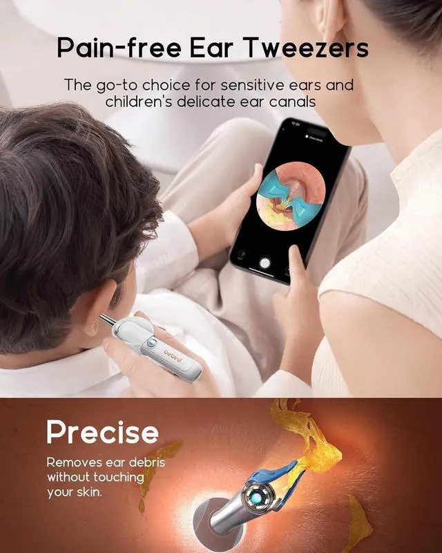 Alt view image 3 of 7 - Earsight Plus R37R Ear Wax Removal Tool Camera, FSA HSA Eligible Items, Smart Ear Cleaner with Painless Visual Tweezers, Flexible Ear Camera Otoscope, Home ENT Cleaning Kit for Family,White