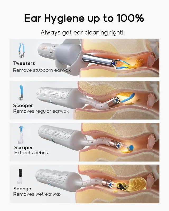 Alt view image 4 of 7 - Earsight Plus R37R Ear Wax Removal Tool Camera, FSA HSA Eligible Items, Smart Ear Cleaner with Painless Visual Tweezers, Flexible Ear Camera Otoscope, Home ENT Cleaning Kit for Family,White