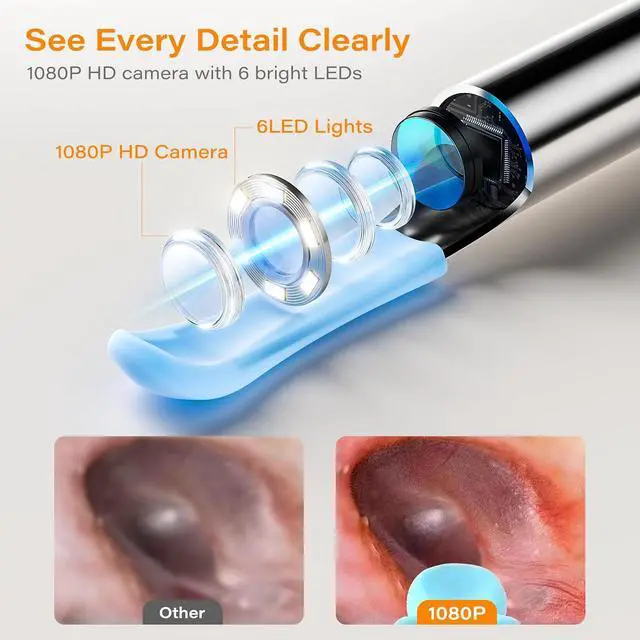 Alt view image 7 of 7 - Ear Wax Removal Tool Camera with Screen, Smart Screen Ear Wax Removal Kit with 2.8'' HD Display, WiFi Automatic Connect - Ear Cleaner Tool with Camera&Screen, 6 Replaceable Tips, No App/Phone Needed