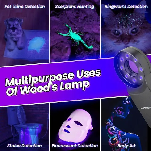 Alt view image 4 of 6 - Woods Lamp with Magnifying Glass, Rechargeable UV Flashlight Skin Analyzer, 365nm Ultraviolet Light LED Black Light for Pet Cat Urine Detection, Resin Curing, Cat Dog Ringworm