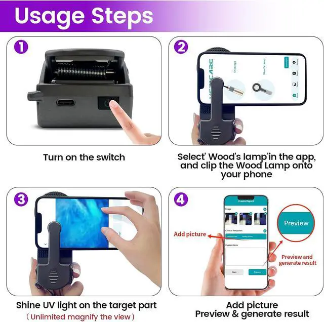 Alt view image 5 of 6 - Woods Lamp with Magnifying Glass, Rechargeable UV Flashlight Skin Analyzer, 365nm Ultraviolet Light LED Black Light for Pet Cat Urine Detection, Resin Curing, Cat Dog Ringworm