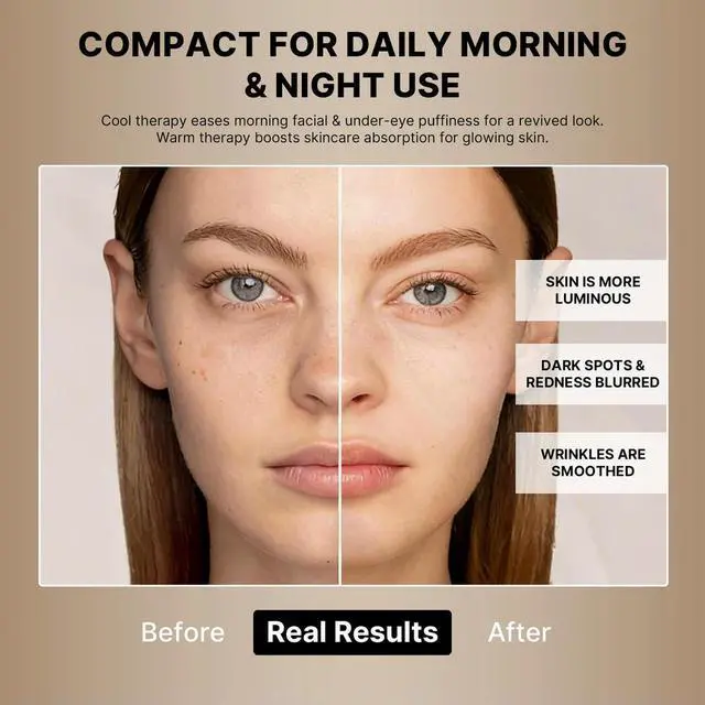Alt view image 2 of 3 - 4 in 1 hot and cold beauty instrument, facial and neck lift massager, best skin care machine, for firming and anti-wrinkle
