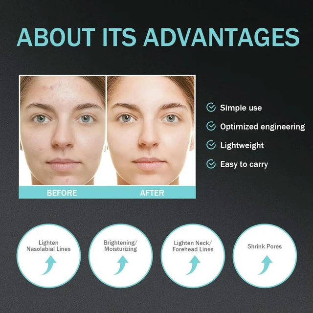 Alt view image 2 of 3 - face-saving equipment, anti-aging and anti-wrinkle electric radio frequency beauty instrument, home eye massager