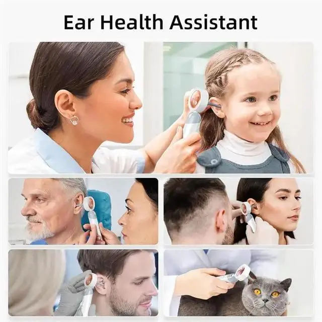 Alt view image 5 of 6 - Ear Otoscope With 1080P HD Camera And 4 LED Lights 1.38" IPS Display Ear Camera Ear Scopes With Inspection Head
