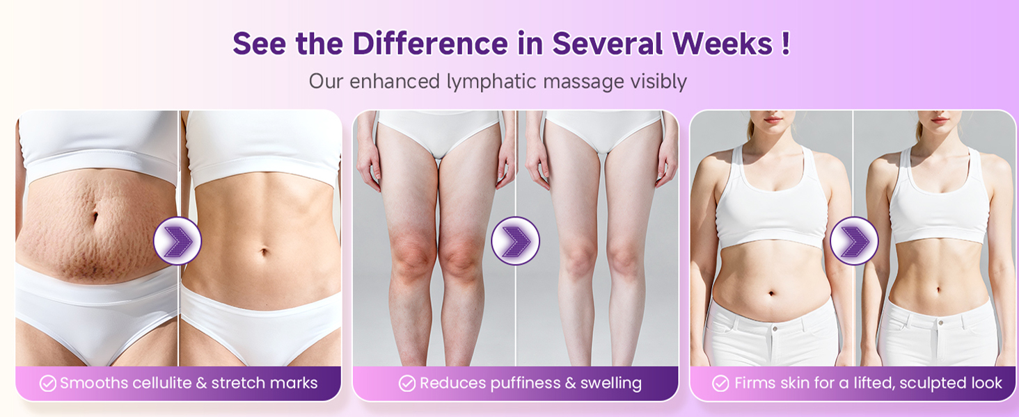 Lymphatic Drainage Massager, Anti Cellulite Massage Tool