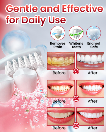 SP-6 Probiotic Whitening Toothpaste, SP-6 Probiotic Toothpaste