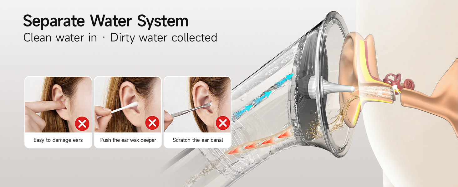 Ear Wax Remover