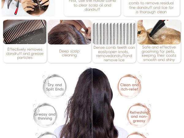 dandruff comb