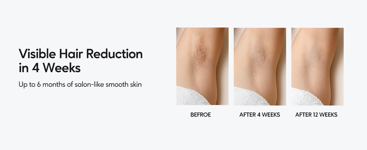a comparison of the skin and skin texture