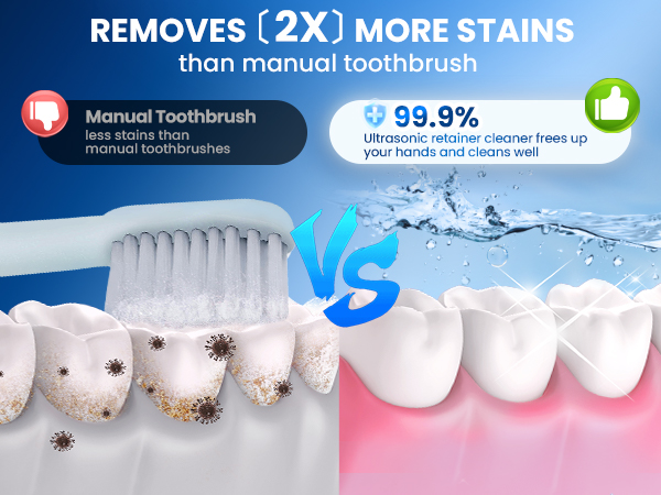 ultrasonic retainer cleaner