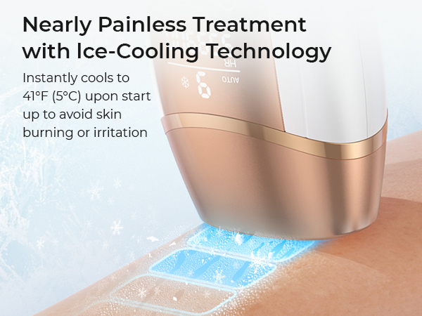 laser hair removal for women