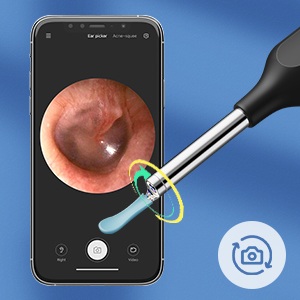 ear wax removal tool camera ear cleaner with camera earwax removal kit ear pick