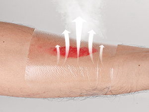 Transparent Film Dressing