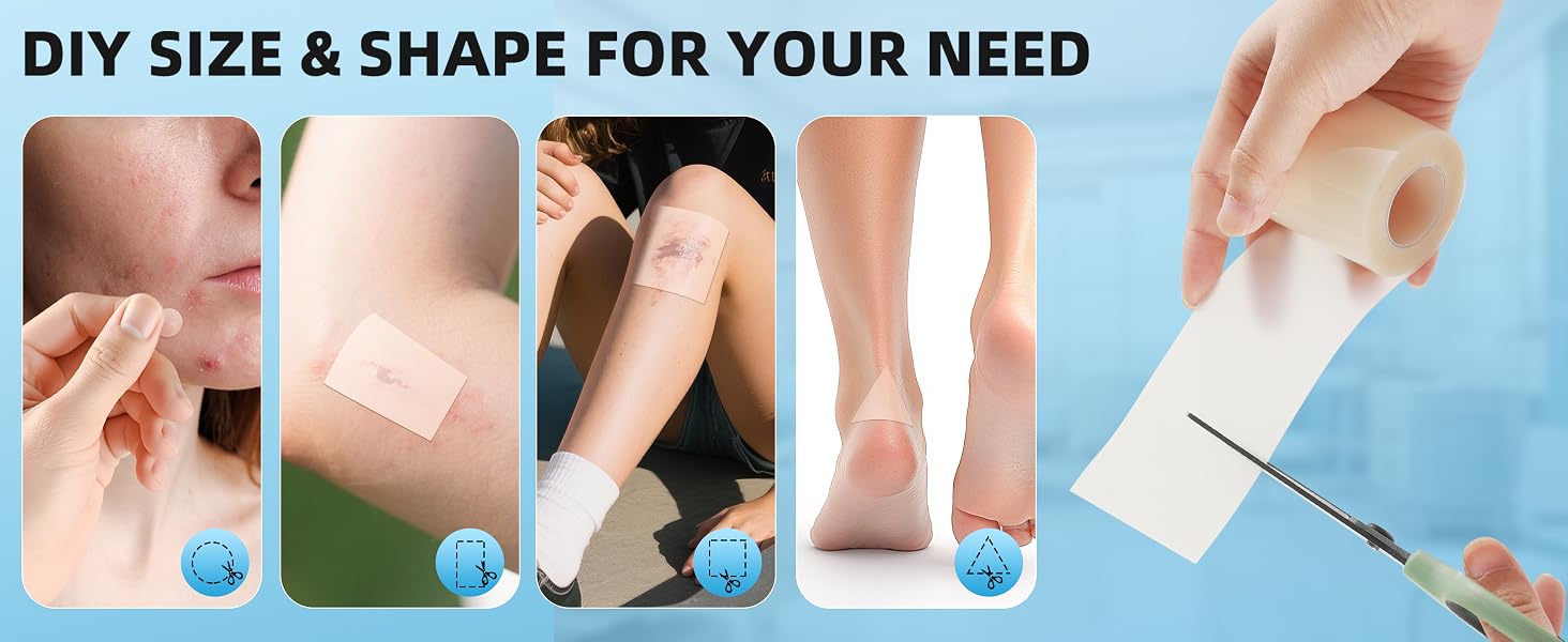 pimple patch roll tape