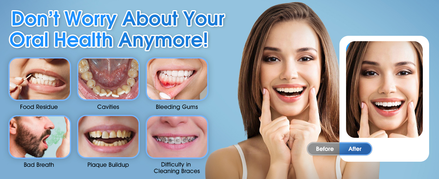 dental water flosser