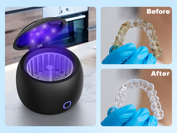 retainer cleaner machine