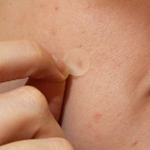 Absorbs spot secretions