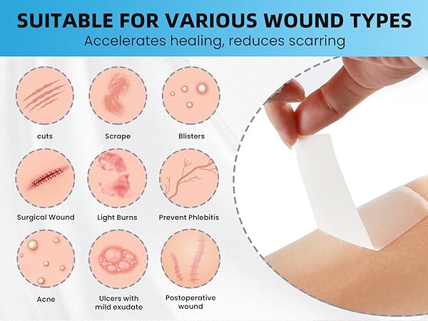 hydrocolloid roll for acne