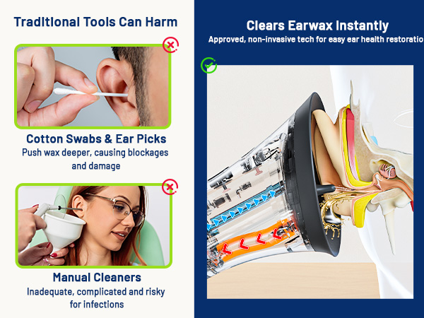 KAUGIC vs Traditional Kit