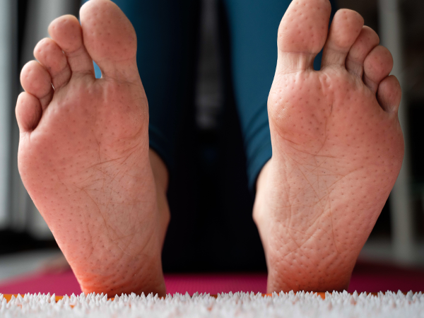 feet with little marks after using acupressure mat, travel size acupressure mat, portable acupressur