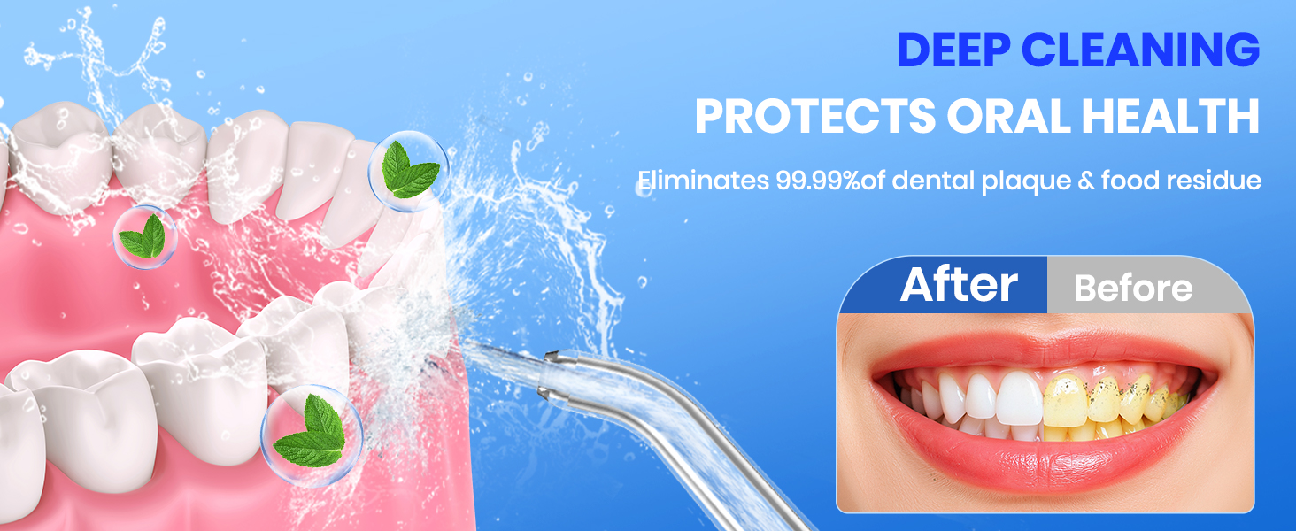 water flosser