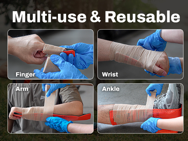sam splint