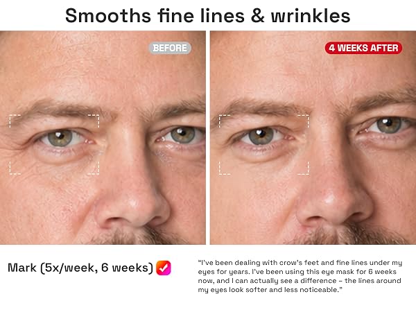 Smooths fine lines and wrinkles
