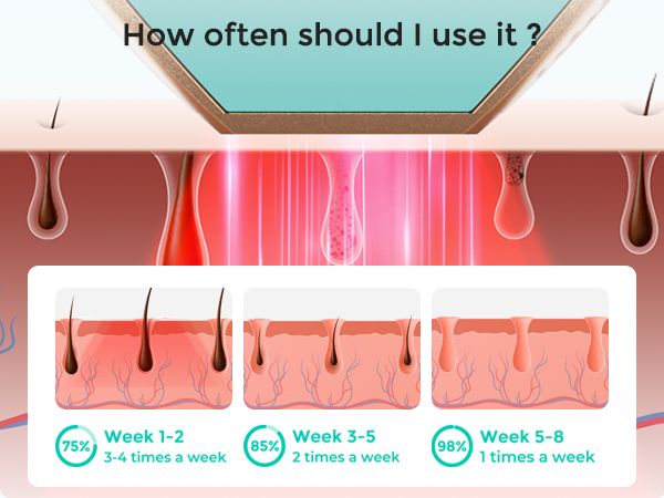 lubex ipl laser hair removal