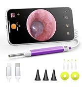 AnyScope Digital Otoscope with Gyroscope, HD Ear Camera with Ear Wax Removal Tools, Video Ear Sco...