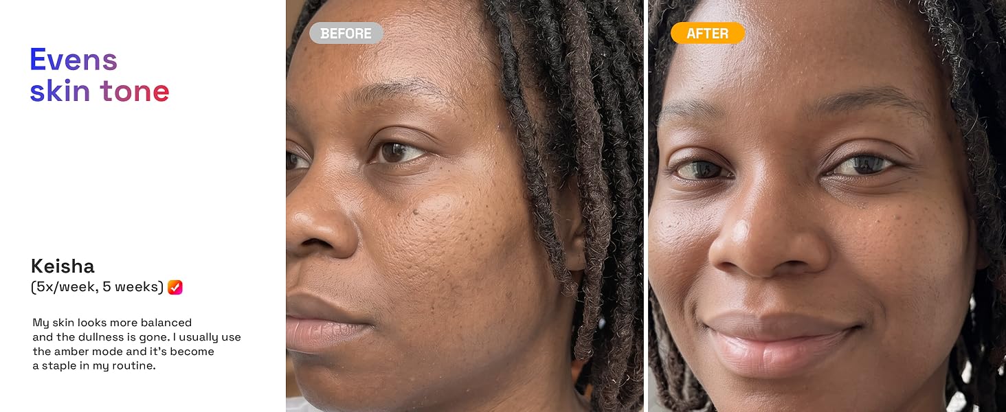 Evens skin tone