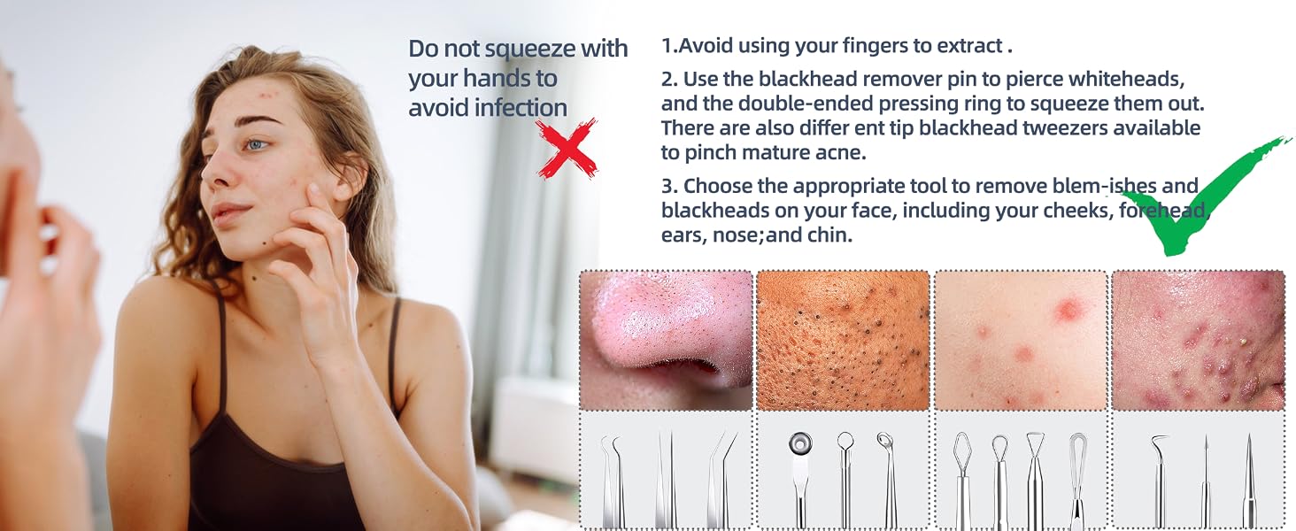 Blackhead Remover