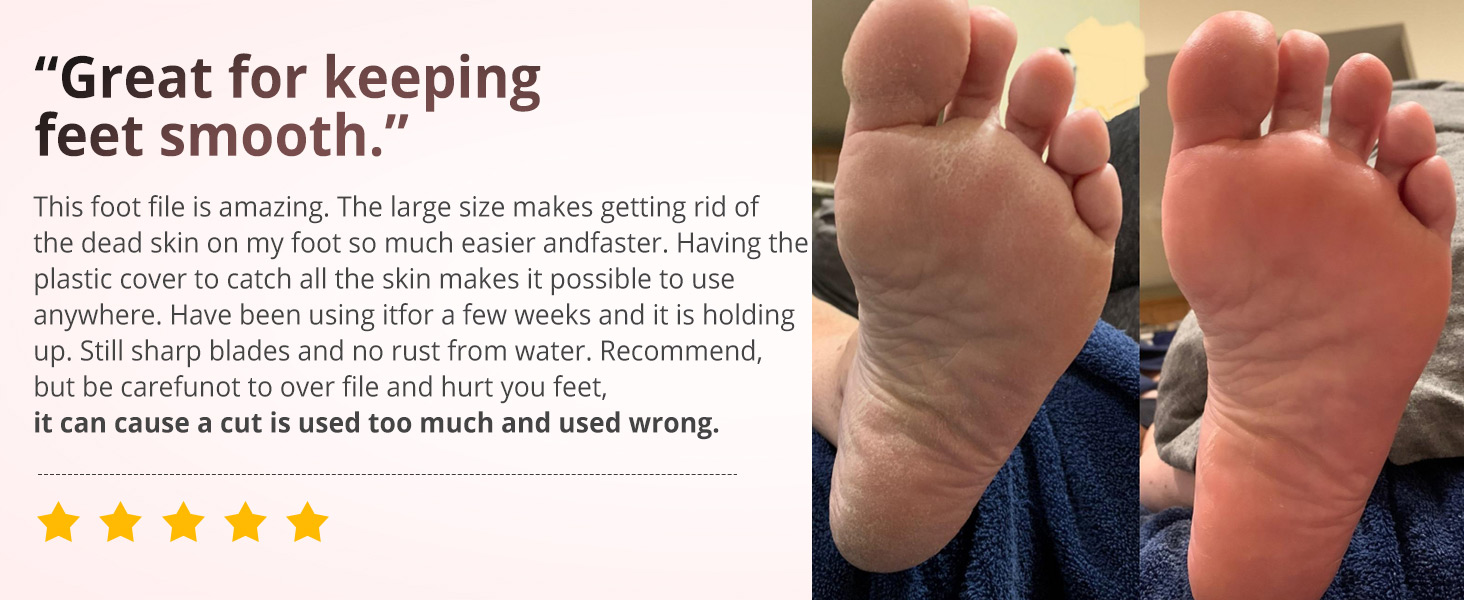 Heel Files for Feet