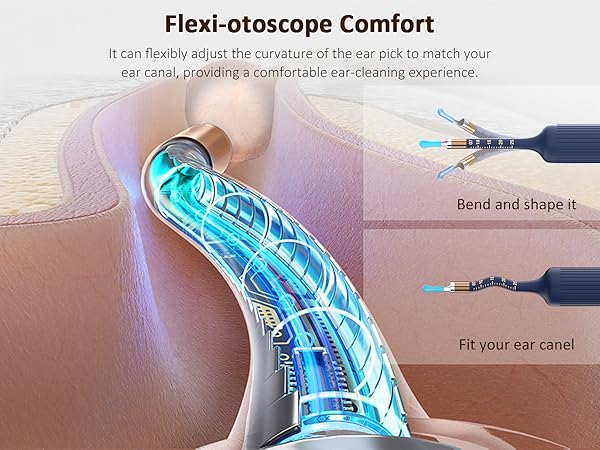 earwax removal kit with camera