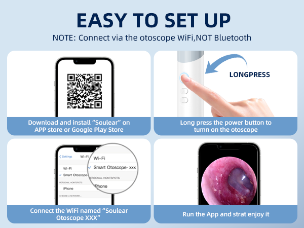 otoscope ear camera
