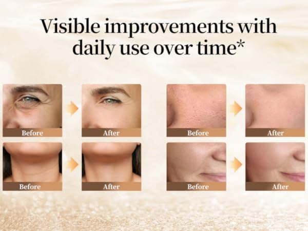 Visible before and after results showing smoother, firmer facial skin