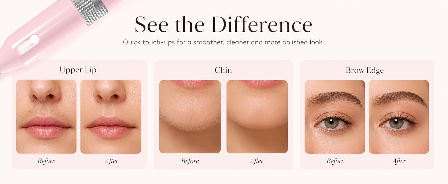 Facial Hair Removal For Women